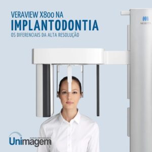 veraviewx800-implantodontia