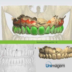 escaneamento-de-superficie -3D