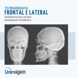 telerradiografia-frontal-e-lateral