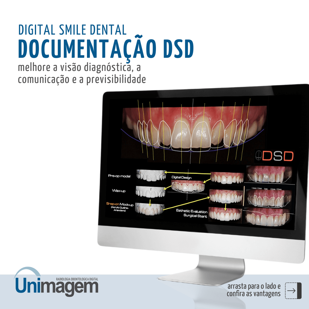 digital-smile-dental