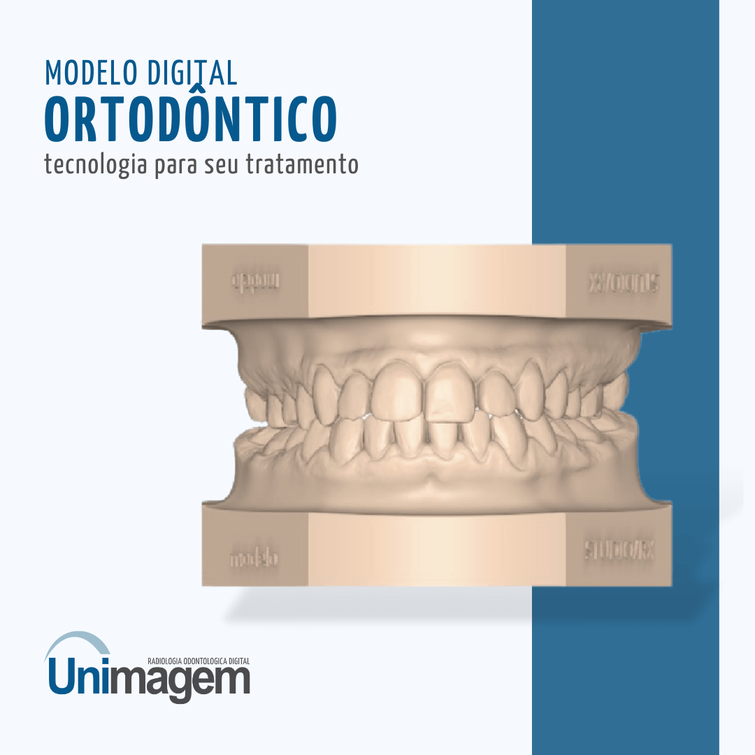 modelo-digital-ortodôntico