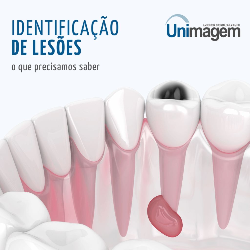 Identificação de lesões