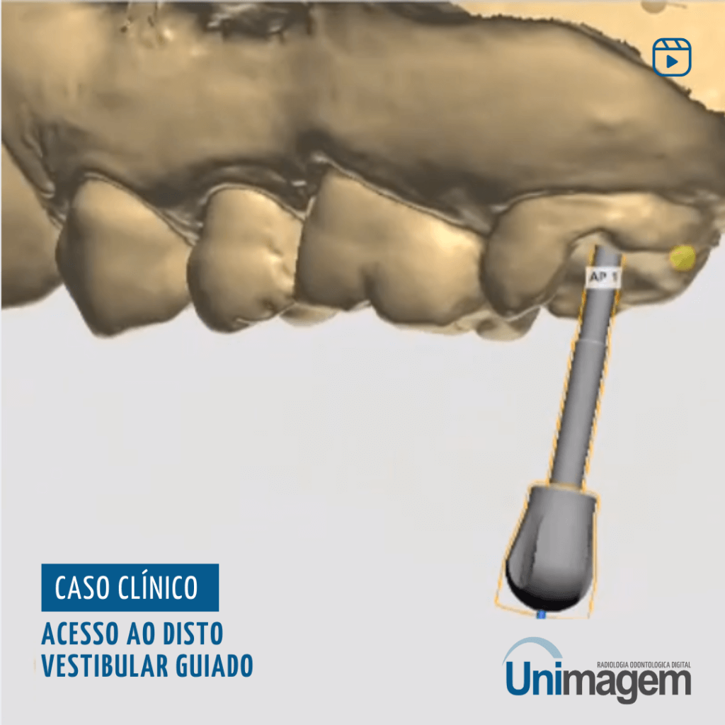 acesso-ao-disto-vestibular-guiado