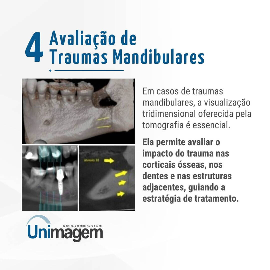 tomografia-no-diagnostico-de-patologias-na-mandibula