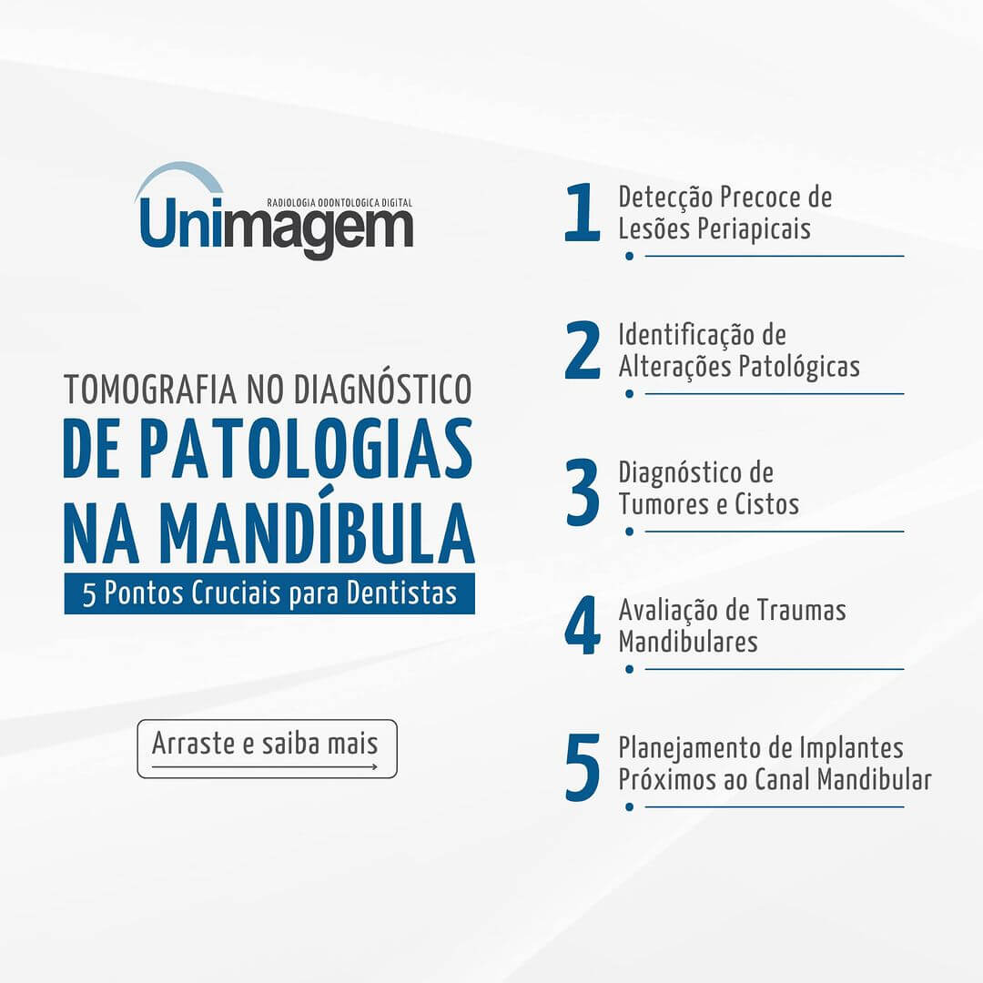 tomografia-no-diagnostico-de-patologias-na-mandibula