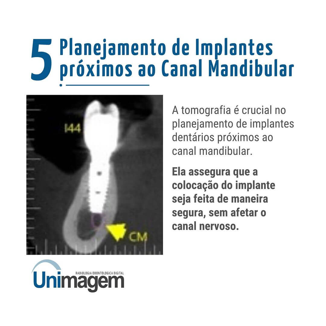 tomografia-no-diagnostico-de-patologias-na-mandibula