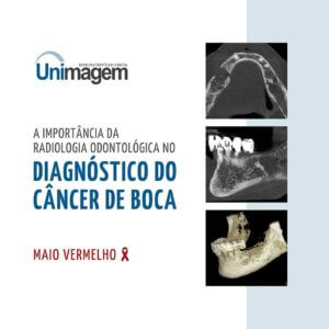 diagnostico-do-cancer-de-boca