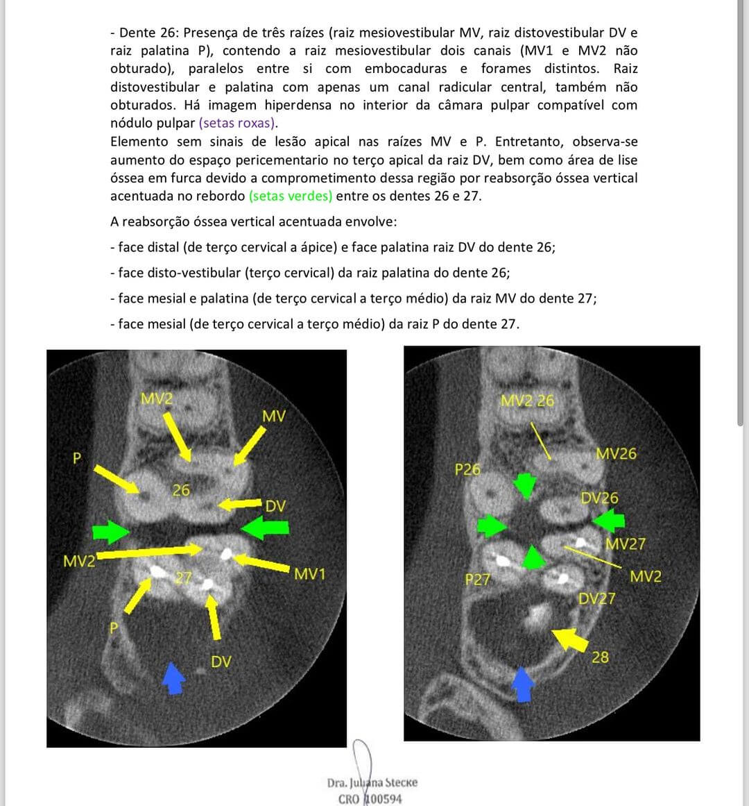 a-tomografia-alem-das-fraturas-e-dos-canais