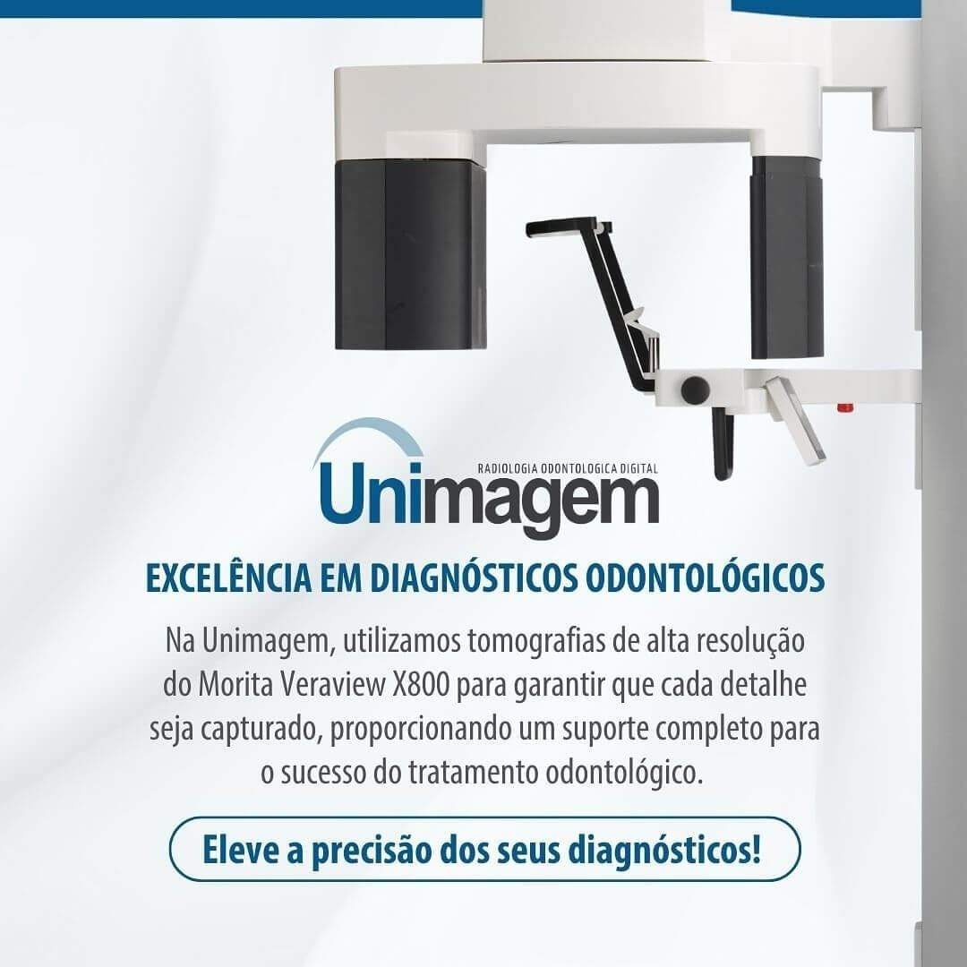 fraturas-alveolares-ocultas