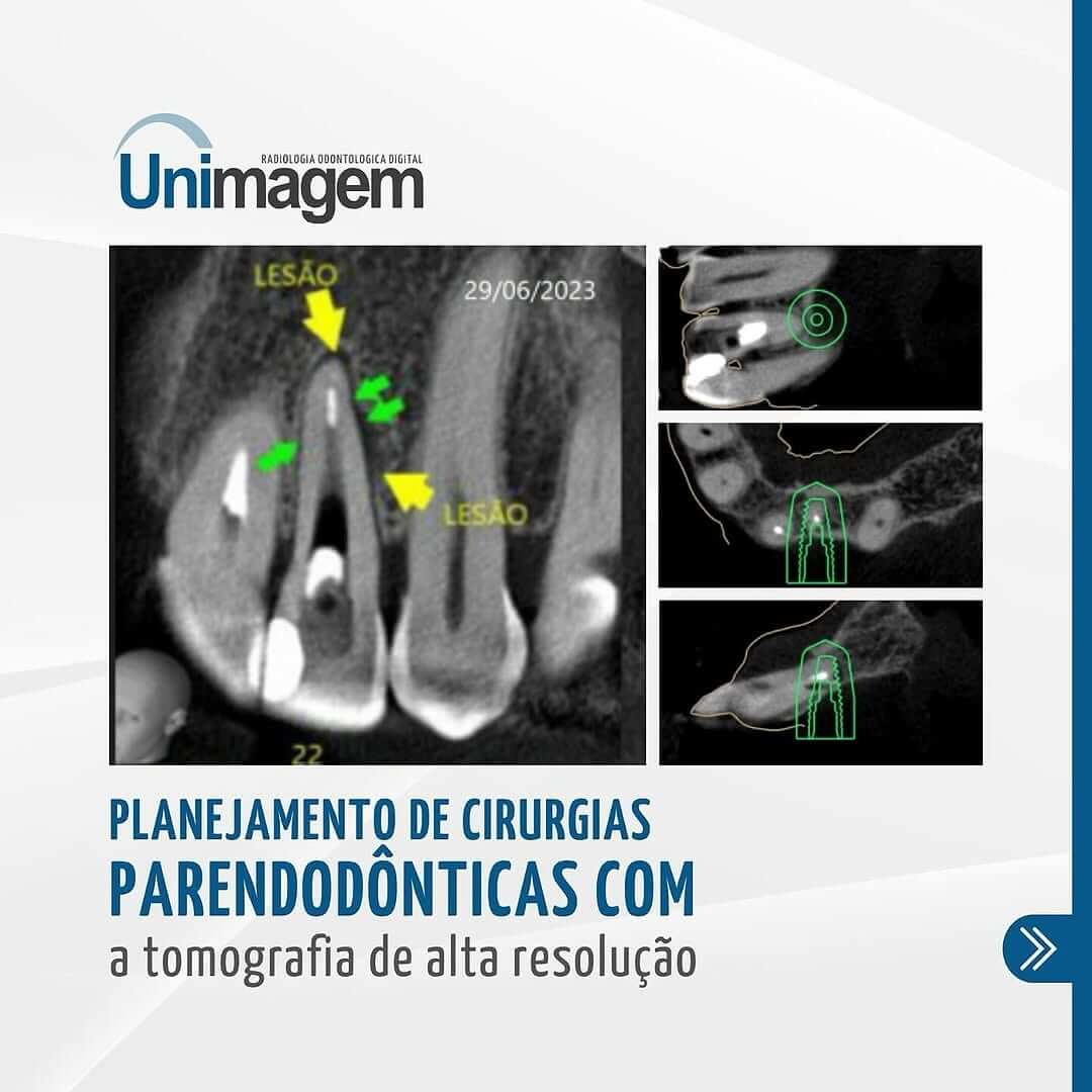 casos-de-alta-complexidade