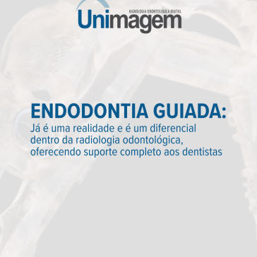 endodontia guiada